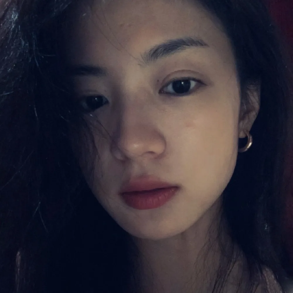 张雅钦双眼皮 图片4